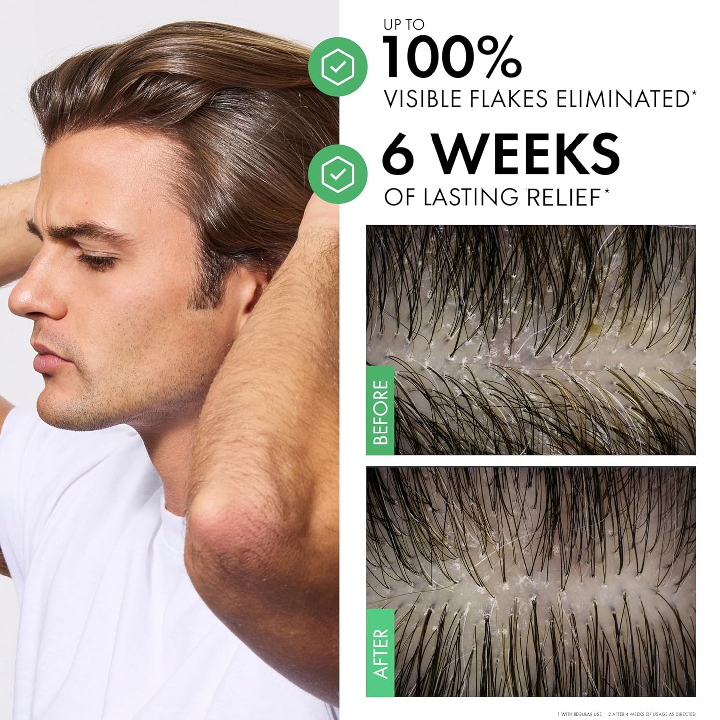 Dercos Selenium Sulfide Anti Dandruff Shampoo - Bajo Pedido