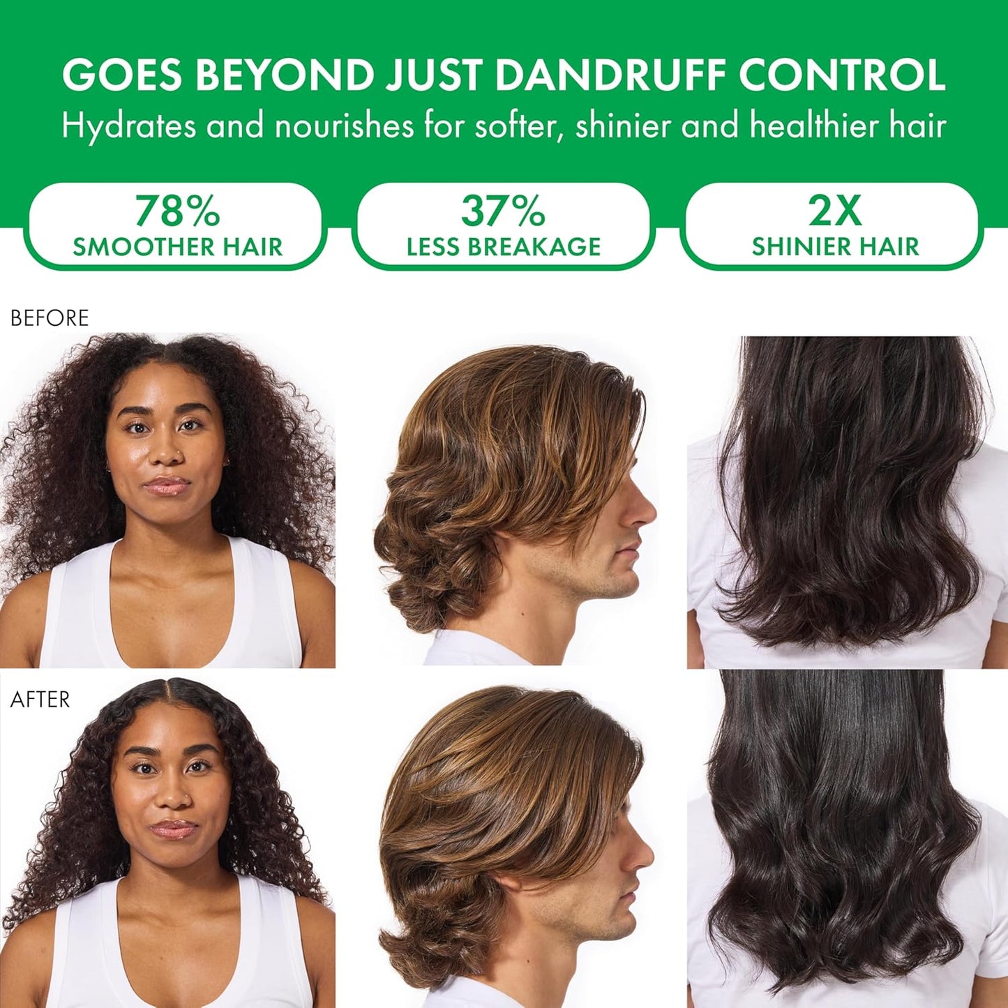 Dercos Selenium Sulfide Anti Dandruff Shampoo - Bajo Pedido