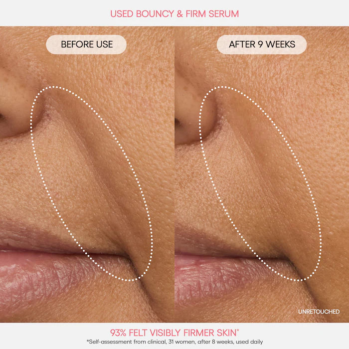 Mini Bouncy & Firm Skin Treats - Bajo Pedido