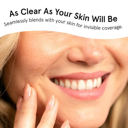 Hydrocolloid Clear Pimple Patches - Bajo Pedido