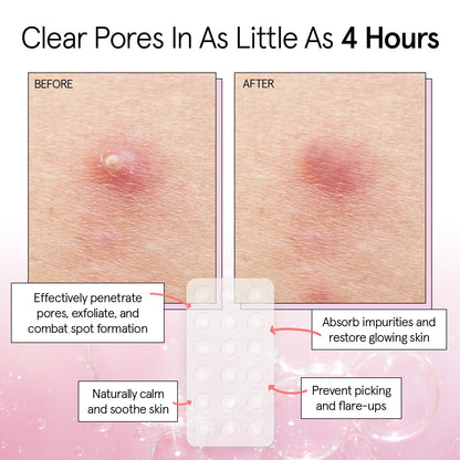 Hydrocolloid Clear Pimple Patches - Bajo Pedido