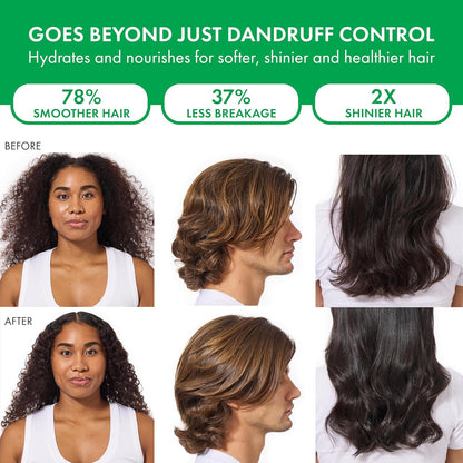 Dercos Selenium Sulfide Anti Dandruff Shampoo - Bajo Pedido