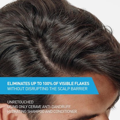Anti Dandruff Hydrating Shampoo - Bajo Pedido
