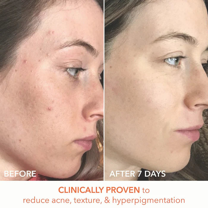 Skincare Must-Haves Set - Bajo Pedido