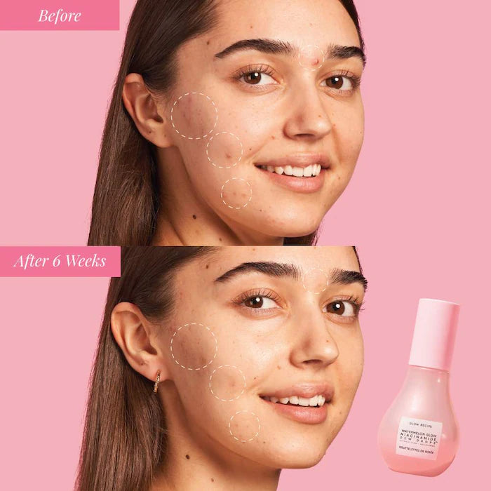 Glow & Go Summer Essentials Kit with Niacinamide - Sephora Sale (Bajo Pedido)