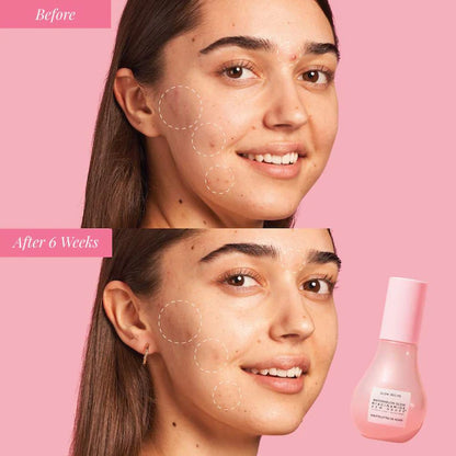 Glow & Go Summer Essentials Kit with Niacinamide - Sephora Sale (Bajo Pedido)
