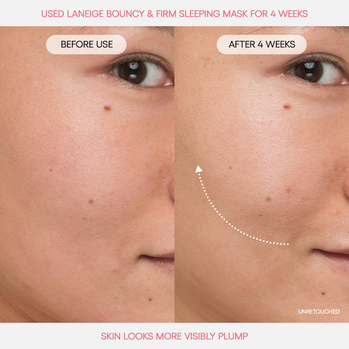 Mini Bouncy & Firm Skin Treats - Bajo Pedido