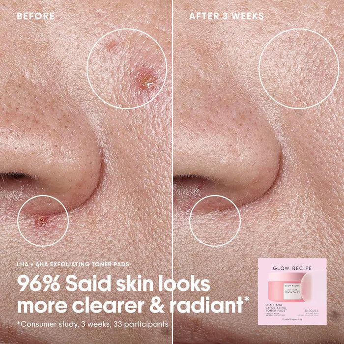Korean Toner Pad Collection Gift Set for Pores, Dark Spots, and Skin Barrier Repair - Sephora Sale (Bajo Pedido)